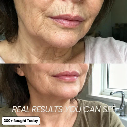 Korean Eye Cream for Dark Circles & Tired Eyes