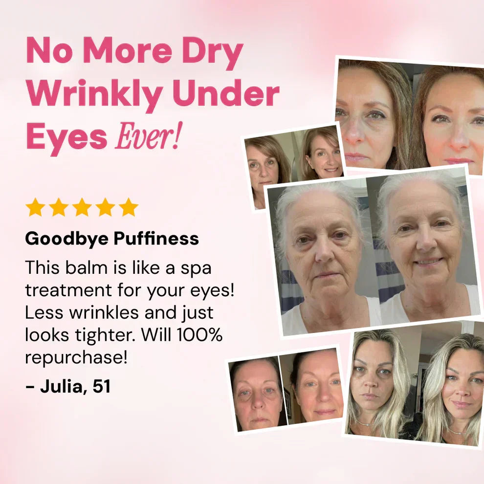 LAST DAY: BUY 1 GET 1 FREE  Revive Tired Eyes with Our Hydrating & Anti-Wrinkle Eye Balm