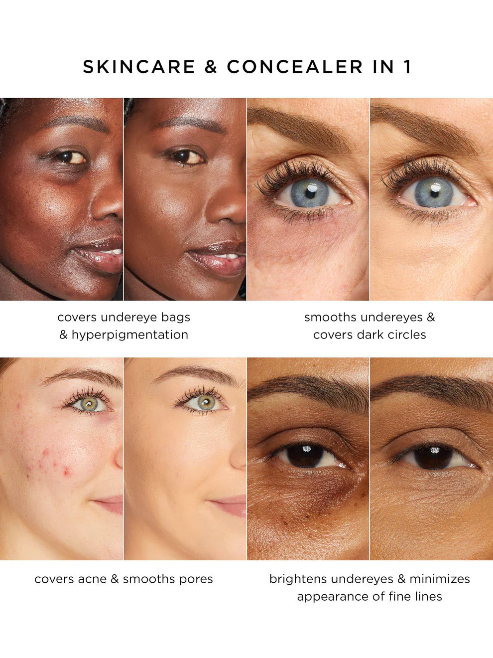Under-Eye Bags? Dark Spots? This Diamond-Tip Concealer Stick Hugs Contours for Flawless Coverage.