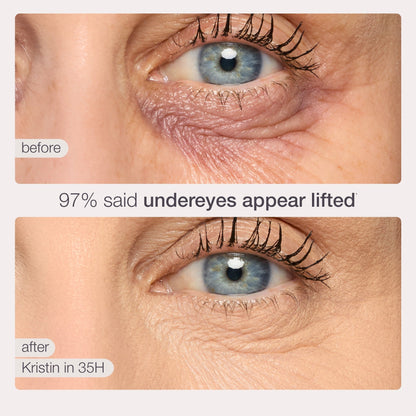 Under-Eye Bags? Dark Spots? This Diamond-Tip Concealer Stick Hugs Contours for Flawless Coverage.