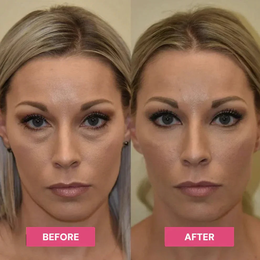 LAST DAY: BUY 1 GET 1 FREE  Revive Tired Eyes with Our Hydrating & Anti-Wrinkle Eye Balm