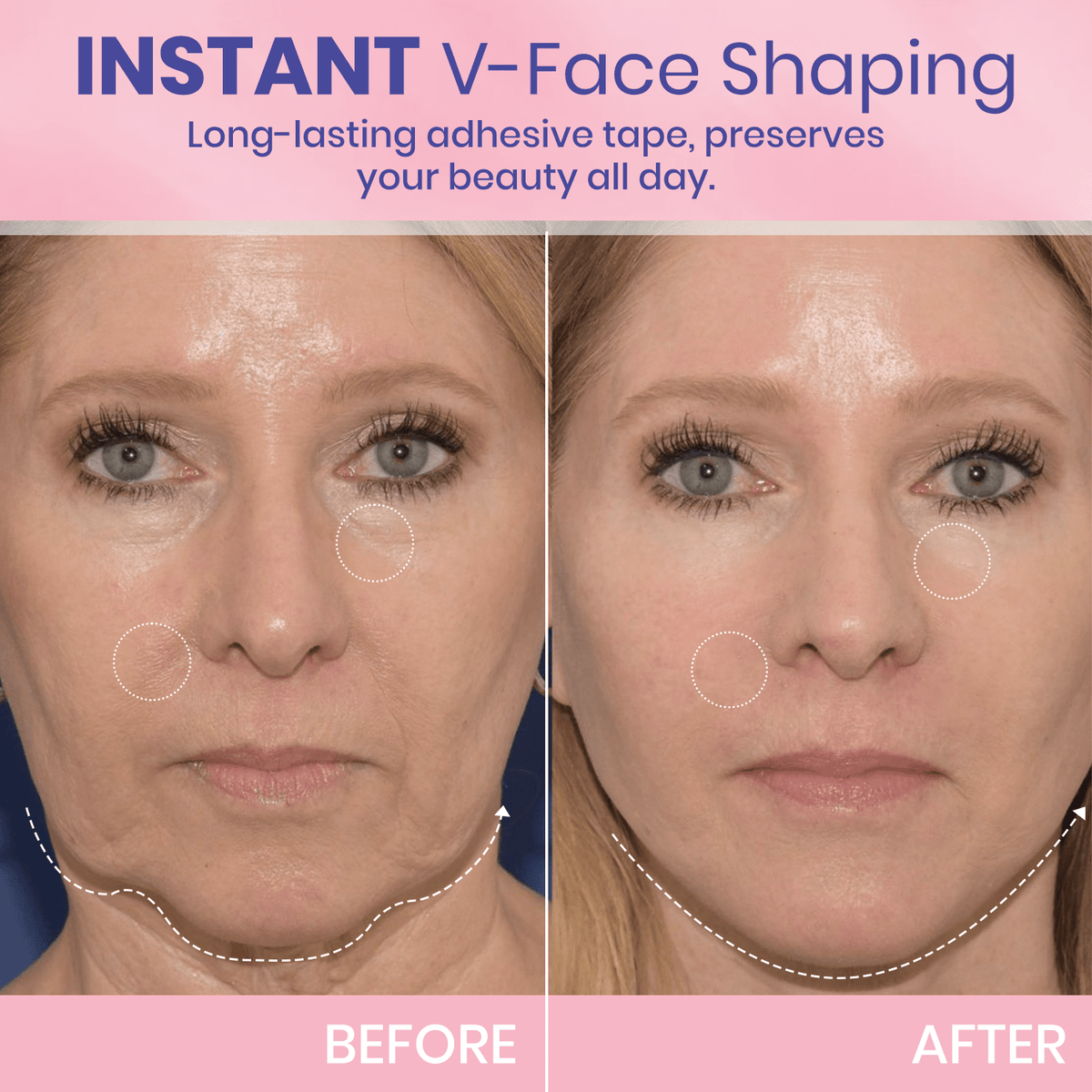 BBOJI™ Invisible Face Lift Tape  Instantly Sculpt Your Jawline & Hide Double Chin