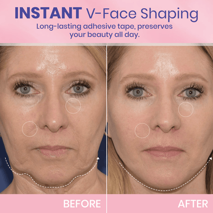 BBOJI™ Invisible Face Lift Tape  Instantly Sculpt Your Jawline & Hide Double Chin