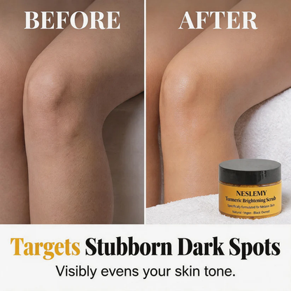 LIMITED-TIME 50% OFF! Turmeric Exfoliating Body Scrub