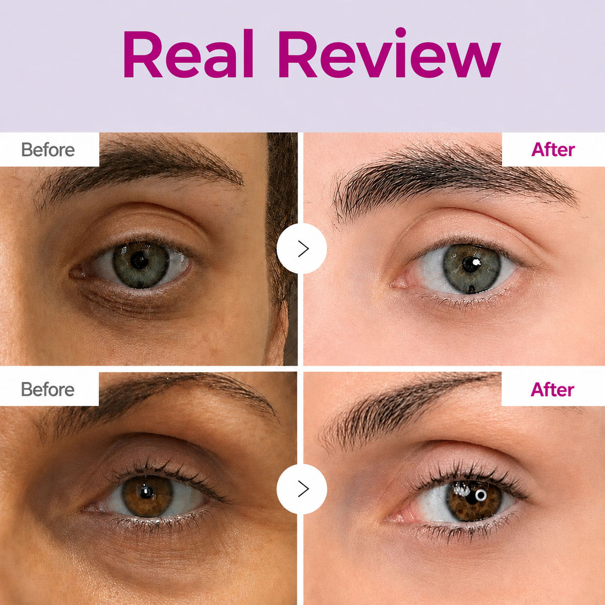 Korean Eye Cream for Dark Circles & Tired Eyes