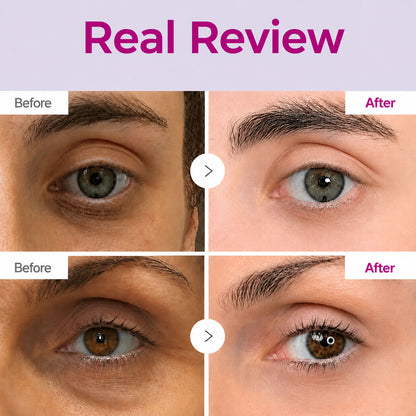 Korean Eye Cream for Dark Circles & Tired Eyes
