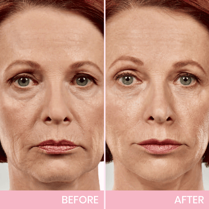 BBOJI™ Invisible Face Lift Tape  Instantly Sculpt Your Jawline & Hide Double Chin