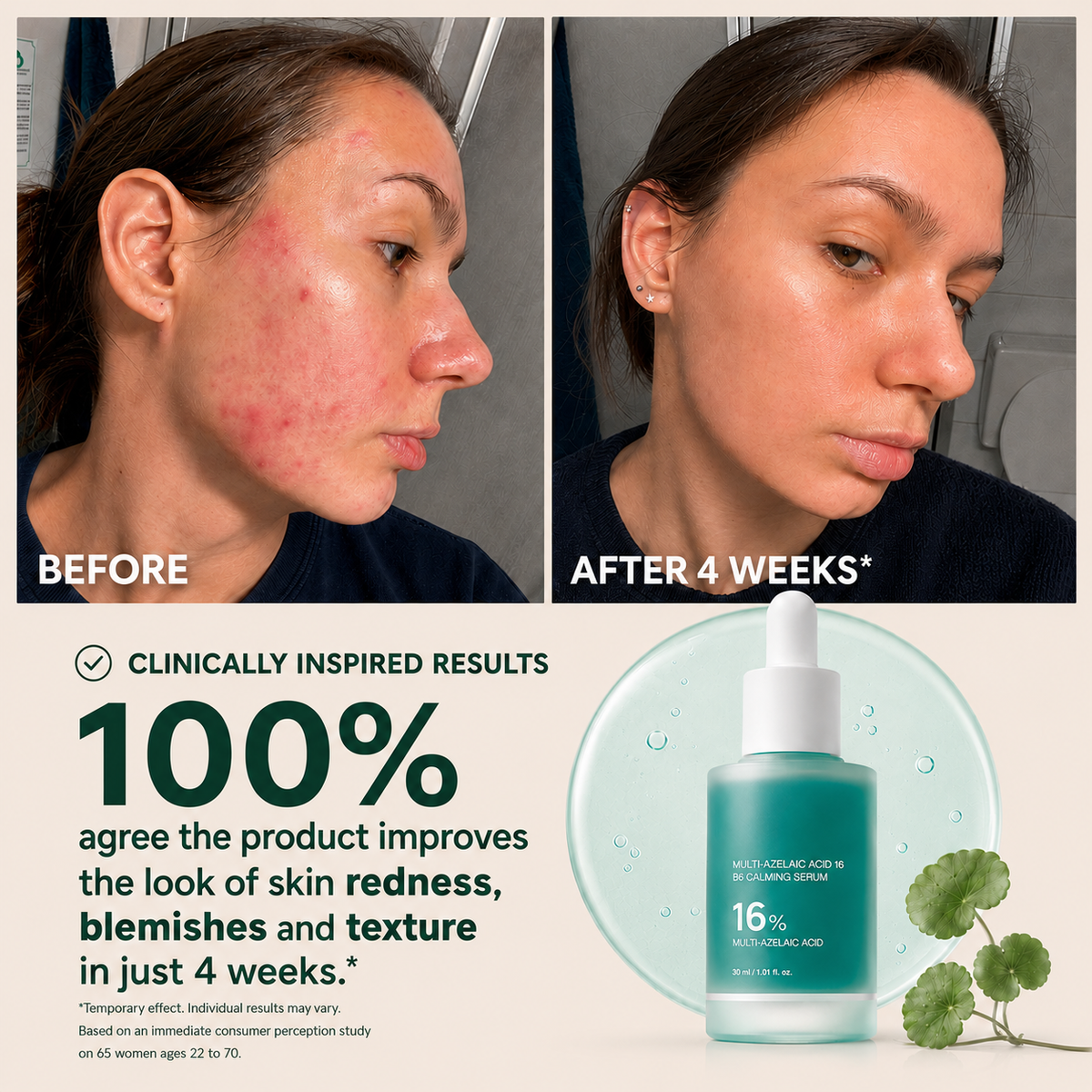 Anchoic Acid Soothing Serum