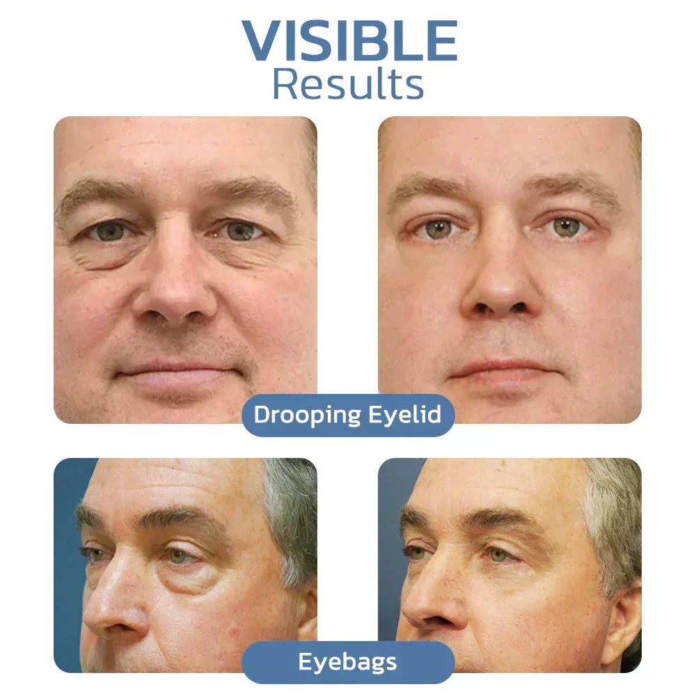 Lovilds™ Awaken Peptide Lifting Eye Gel