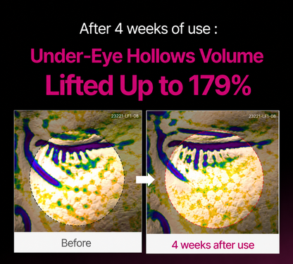 Korean Eye Cream for Dark Circles & Tired Eyes