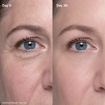 🔥 50% OFF Ends in 2 Hours ⏳ Dark Circles & Wrinkles Fade Fast ✨